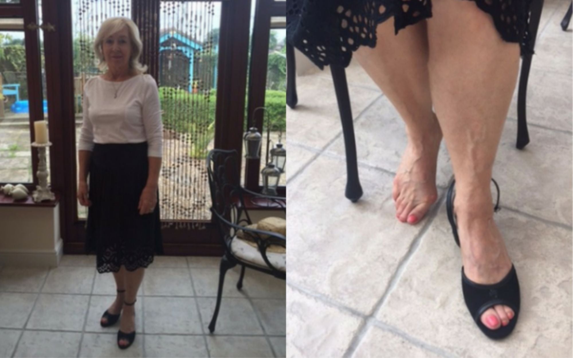 elegant and comfortable shoes for bunions review of calla shoes