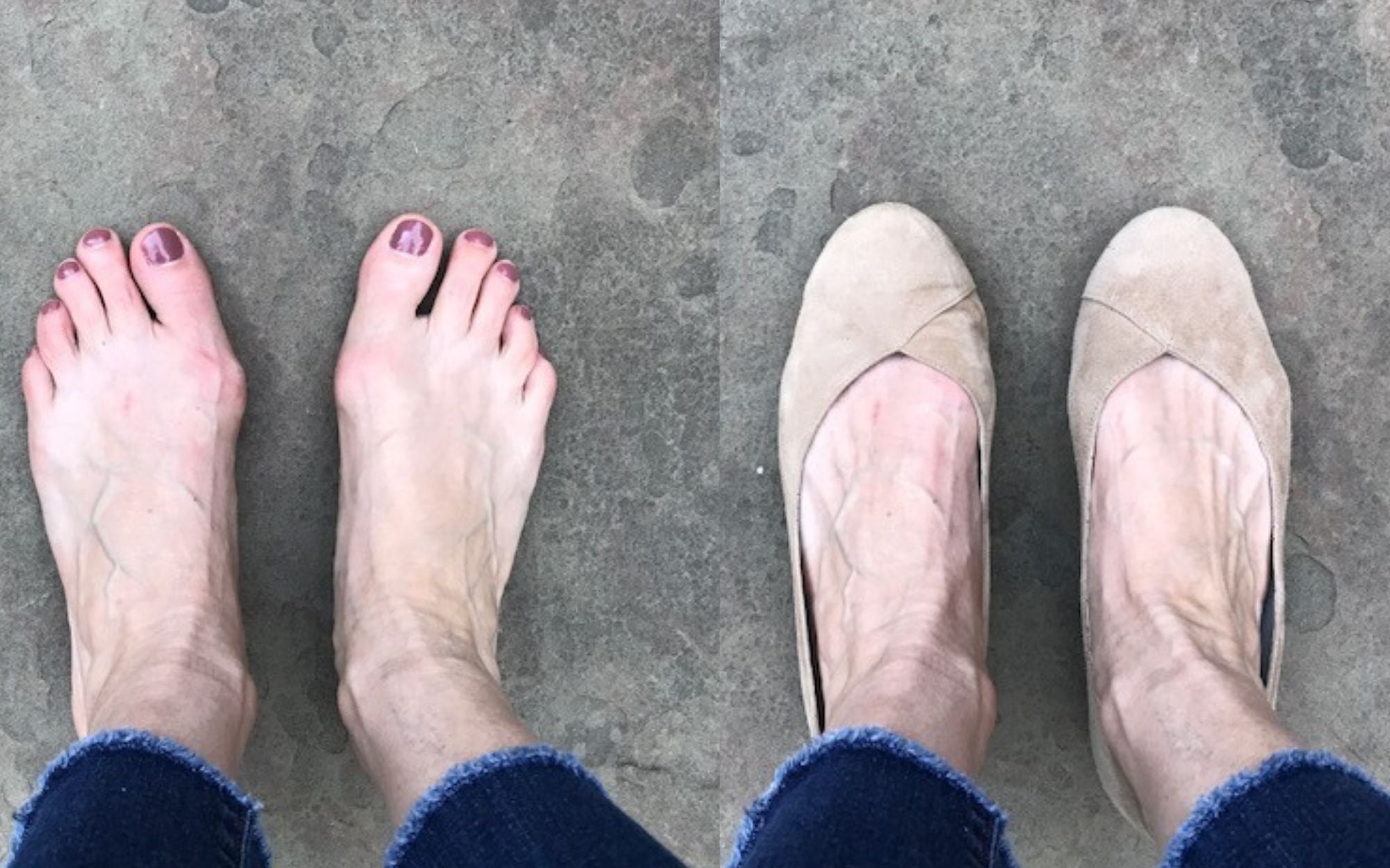 customer reviews flat shoes for bunions comfortable on bunions