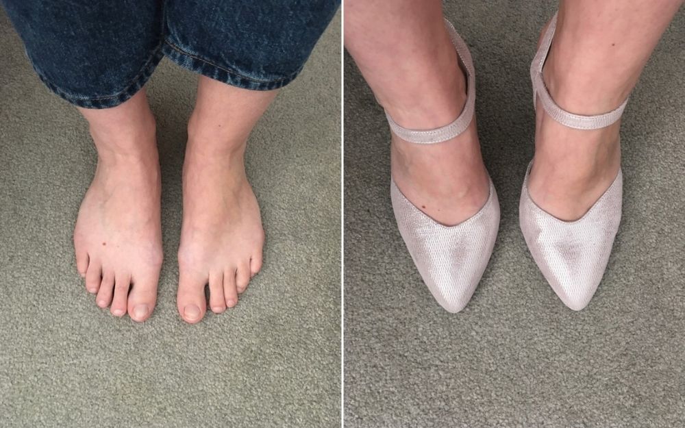 review of calla shoes for bunions by customer