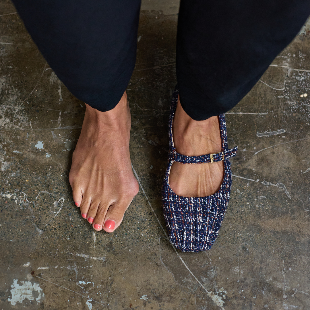 Could You Have Bunions? The Stylish Woman’s Guide to Foot Health
