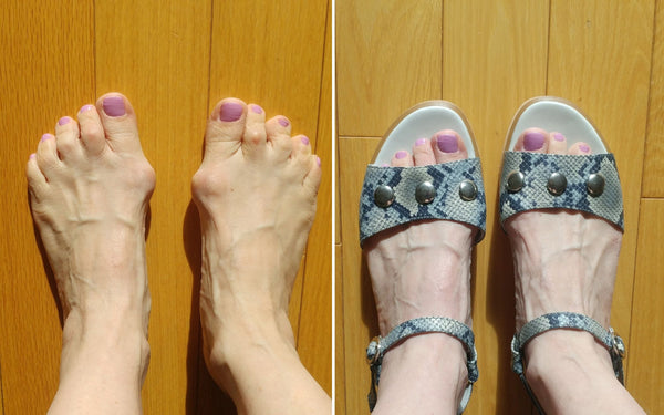 happy customer review for calla shoes bunions and sandals