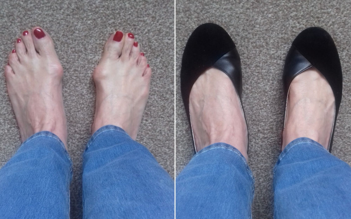 Review of Calla Shoes | Susan's feet love it