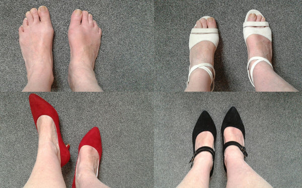 review of heels for bunions by calla shoes comfortable and fashionable