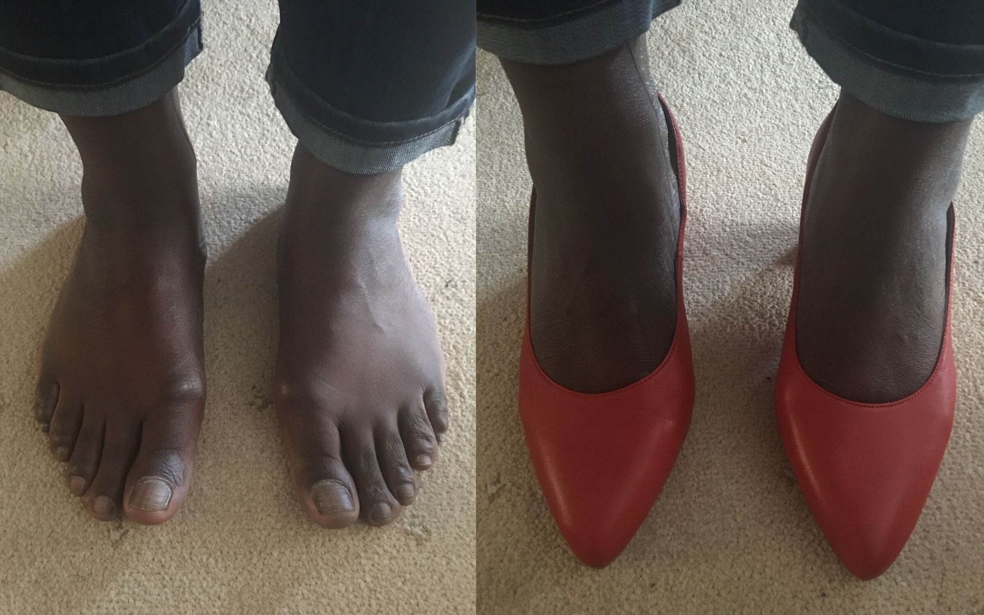 customer reviews of red leather heels for bunions