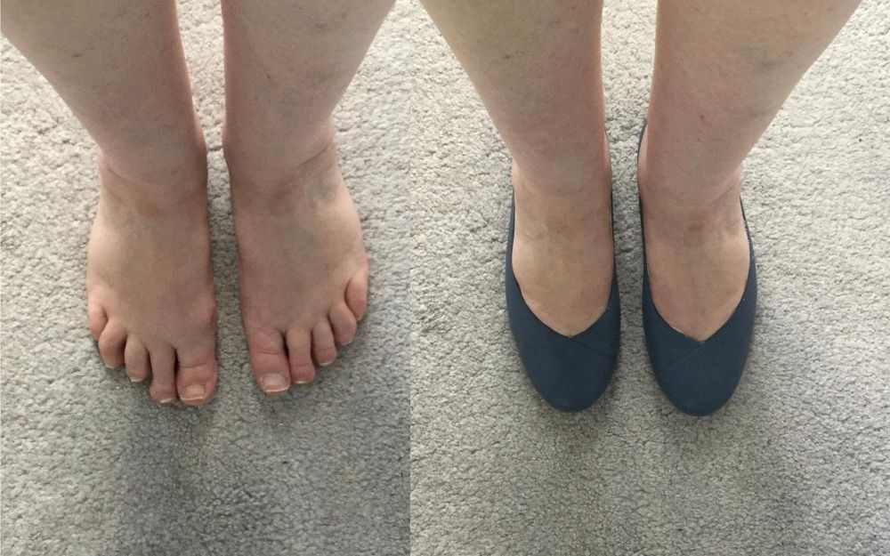 a photo of feet and a photo of feet in shoes