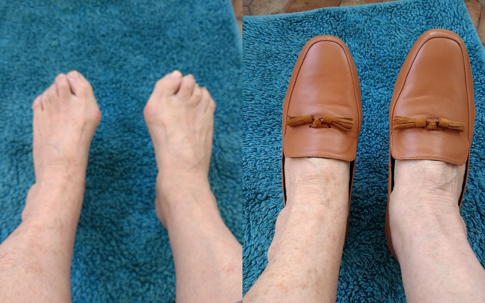 customer reviews flat shoes for bunions comfortable on bunions