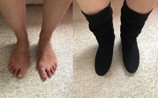 review of calla shoes for bunions