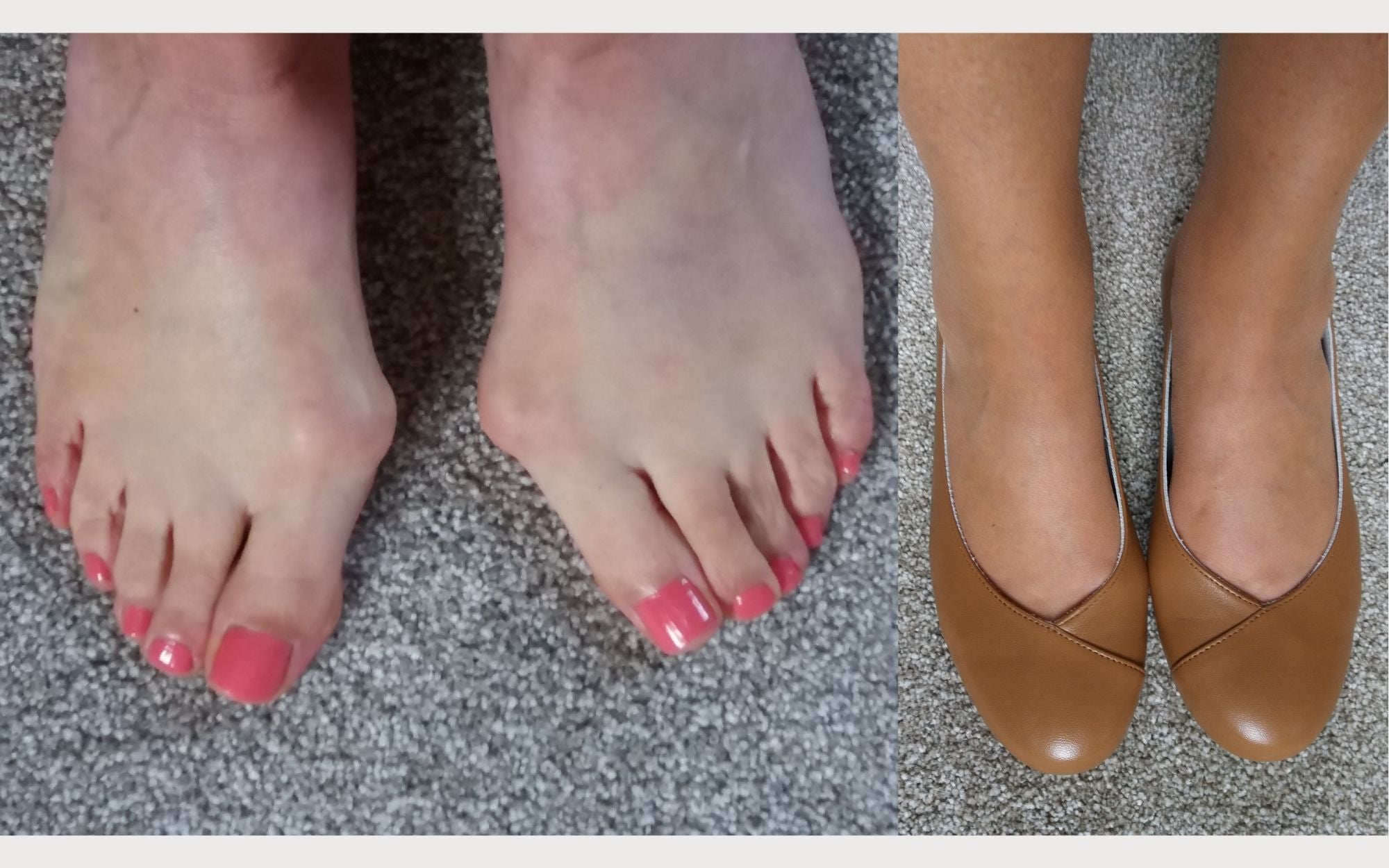 customer photo review showing their feet with and without shoes