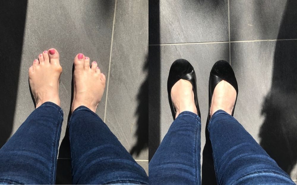 photo review of calla shoes for bunions