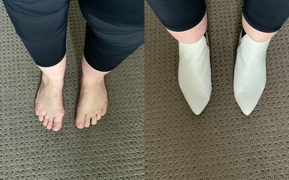 review of calla shoes for bunions