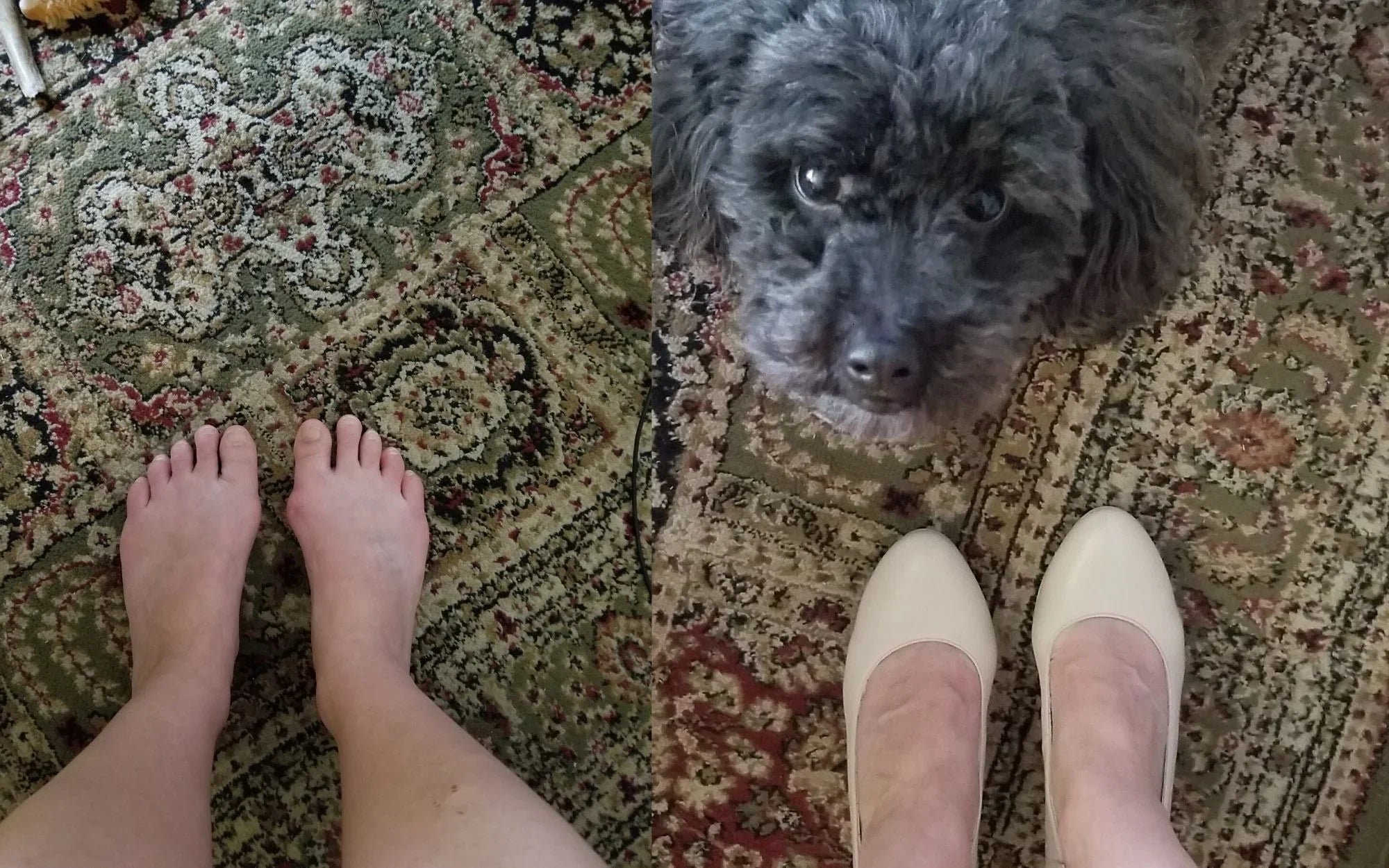 Best Women's Shoes for Bunions That Don't Sacrifice Style