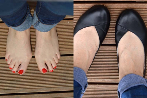 feet with bunions wearing black flat shoes