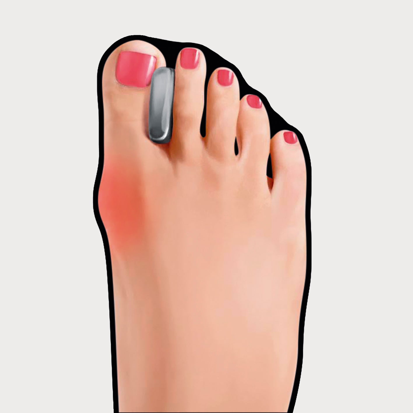 foot with go bunion toe separator 